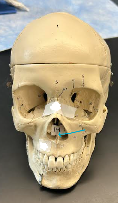 <p>ID skull region </p>