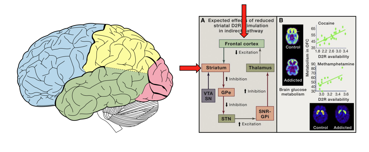 <ul><li><p>Reduced activity (particularly in the orbitofrontal cortex) may be associated with reduced ability to assess value and control behavior</p></li></ul><div data-type="horizontalRule"><hr></div><ul><li><p></p></li></ul><p></p>