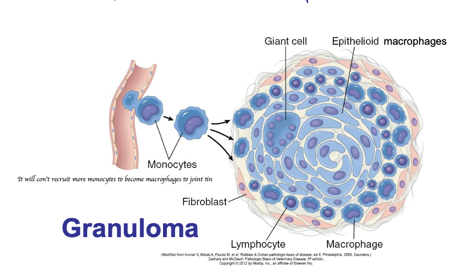 <ul><li><p>Rim of fibroblasts and connective tissue </p></li><li><p>Periphery: Lymphocytes and plasma cells </p></li><li><p>Centre: Macrophages and epithelioid cells </p></li></ul><p></p>