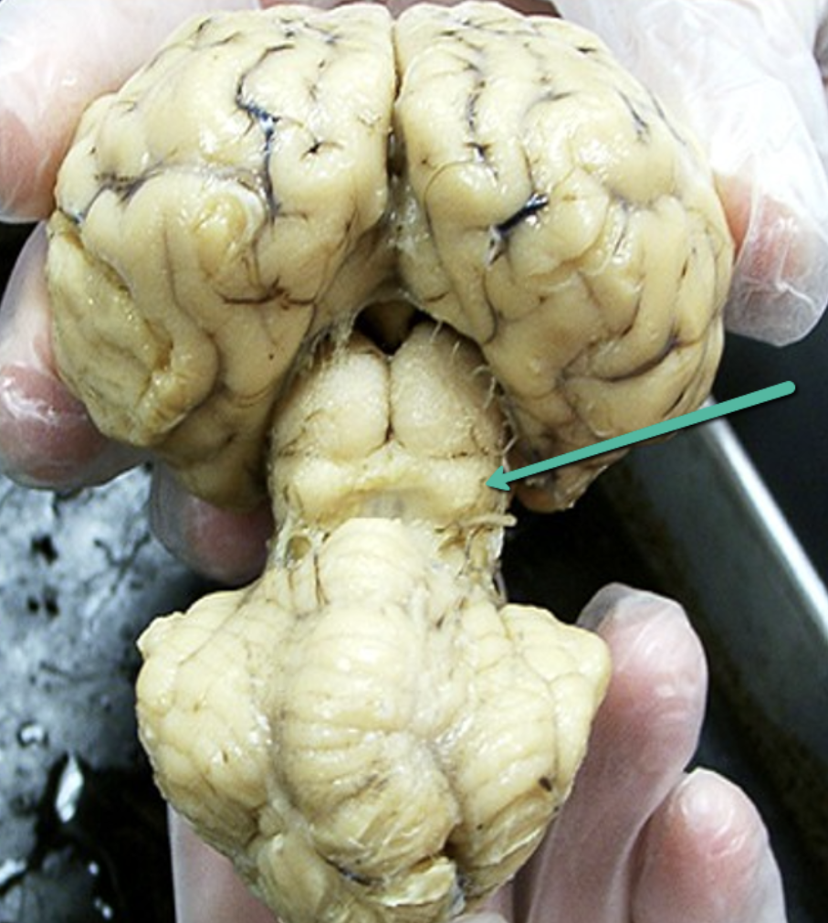 <p>Identify the structure indicated by the pointer.</p>