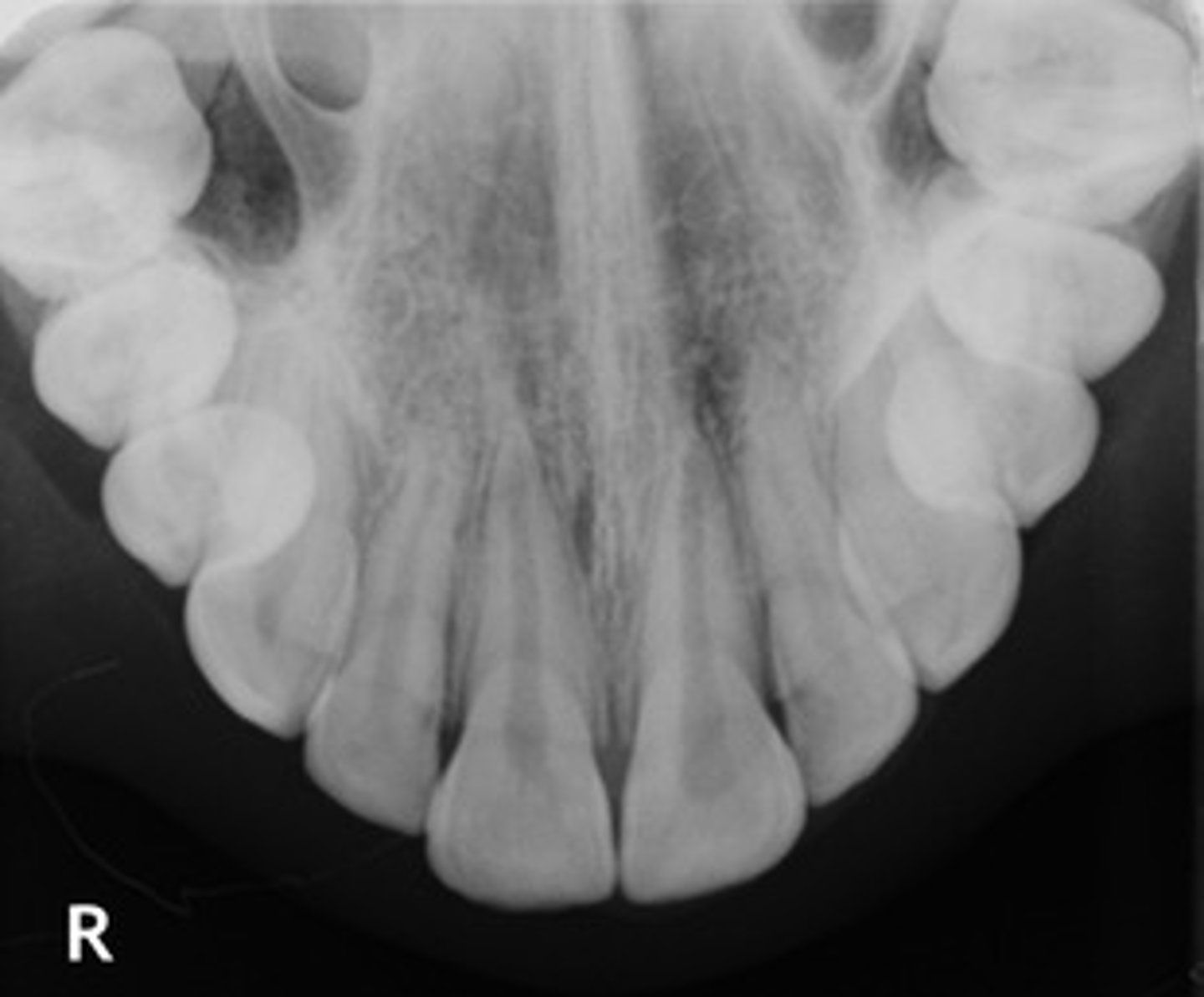 <p>help track the development & placement of a section or entire arch of teeth in the upper or lower jaw</p>