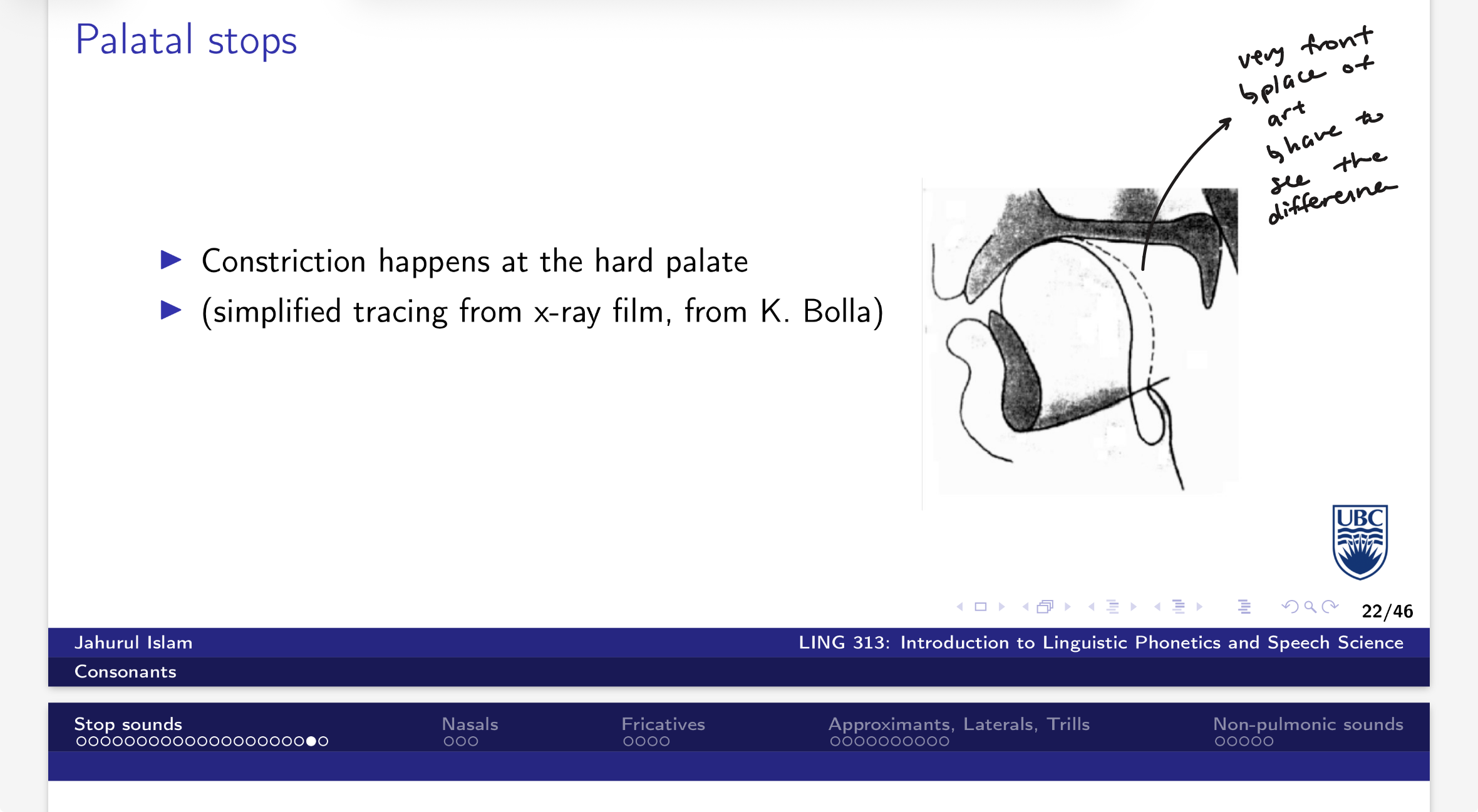 <p>constriction happens at the hard palate</p>