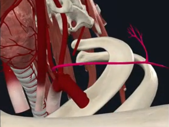 <p>Transverse Cervical artery</p>