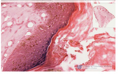 <p>What is the brown granular material in this slide of a dog's lip called?</p>