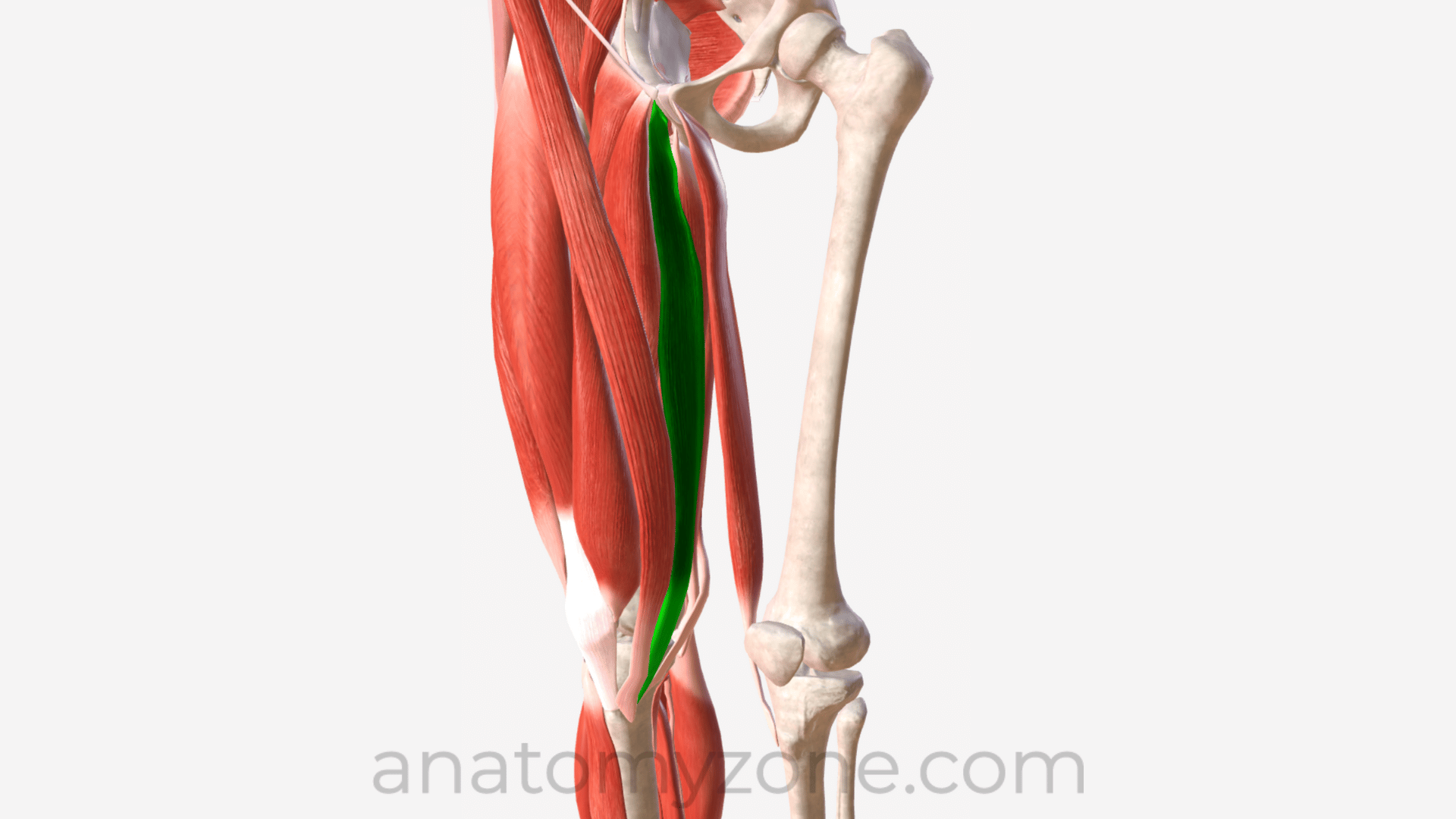 <p>What muscle is this?</p>
