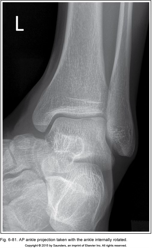 <p>AP ankle</p>