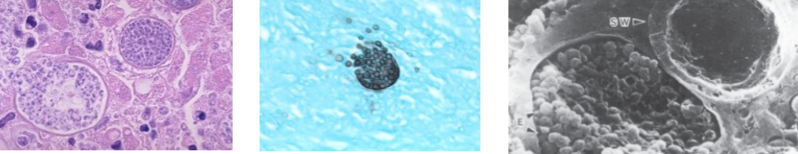 <p>arthroconidia is infectious unit from soil, looks like spherule with endospores</p>