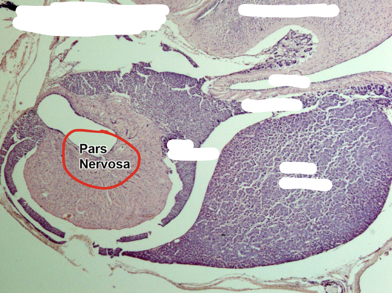 <p>Posterior pituitary </p>