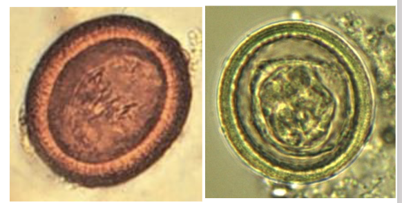<p>describe the tapeworm egg</p><p>… with a … …. …</p>