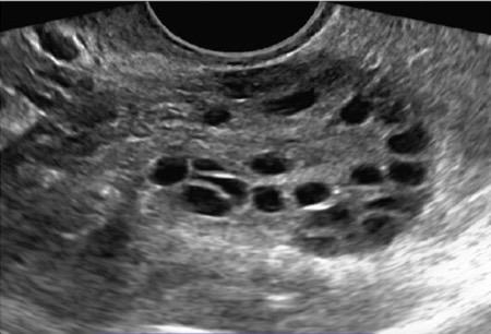 <p>What are these images of?</p>