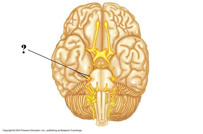<p>Identify the indicated cranial nerve</p>