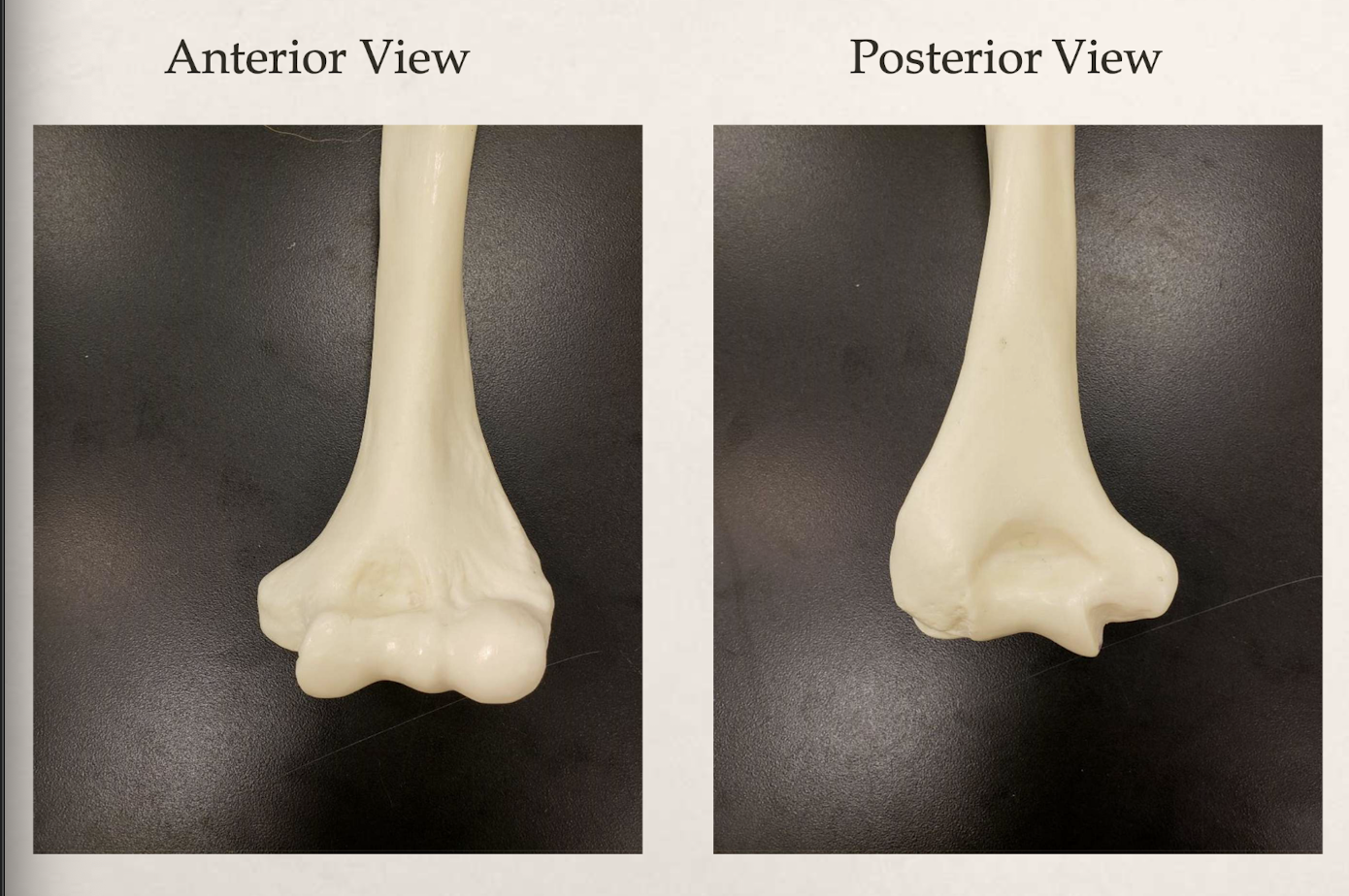 <p>pawn is anterior, olecranon fossa is posterior</p>