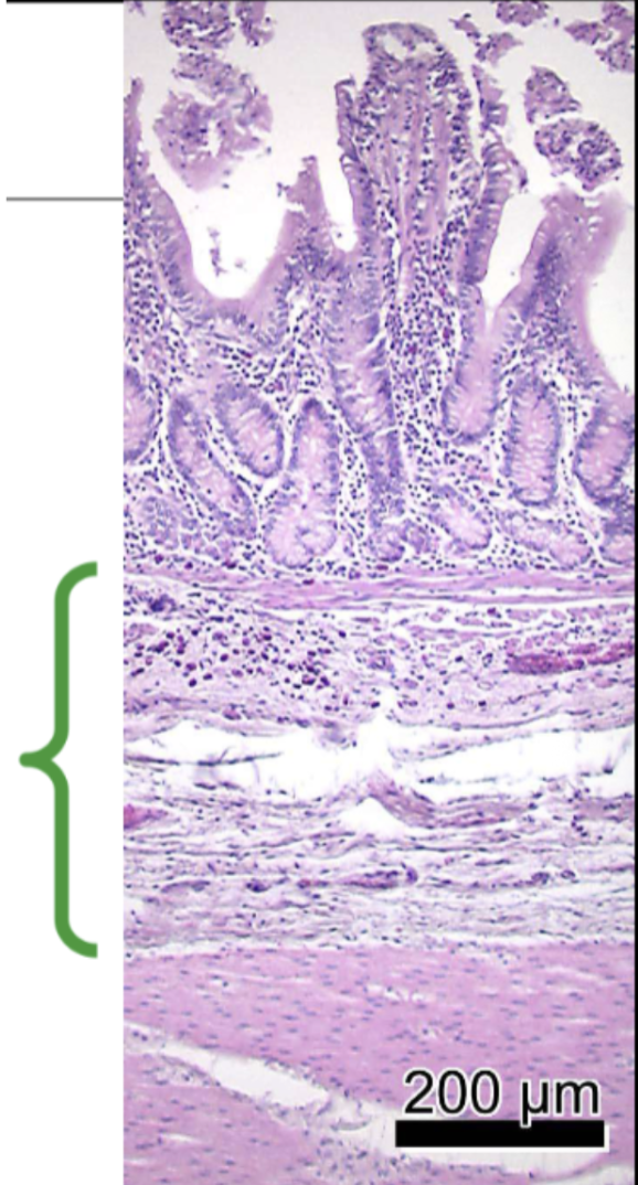 <ul><li><p>Loose CT,</p></li><li><p>Larger blood vessels</p></li><li><p>Lymphatics</p></li><li><p>Nerve plexus</p></li><li><p>Ganglion cells</p></li></ul><p></p>