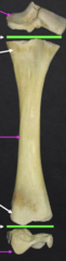 <p>What is the middle pink arrow pointing to?</p>