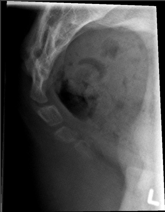 <p>critique for coccyx lateral </p>