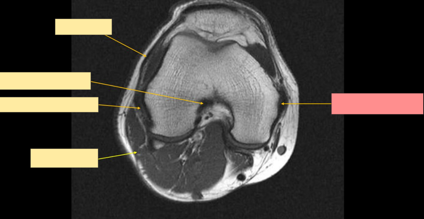 <p>Identify the structure</p>