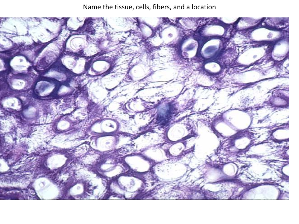 <p>Location of this tissue?</p>