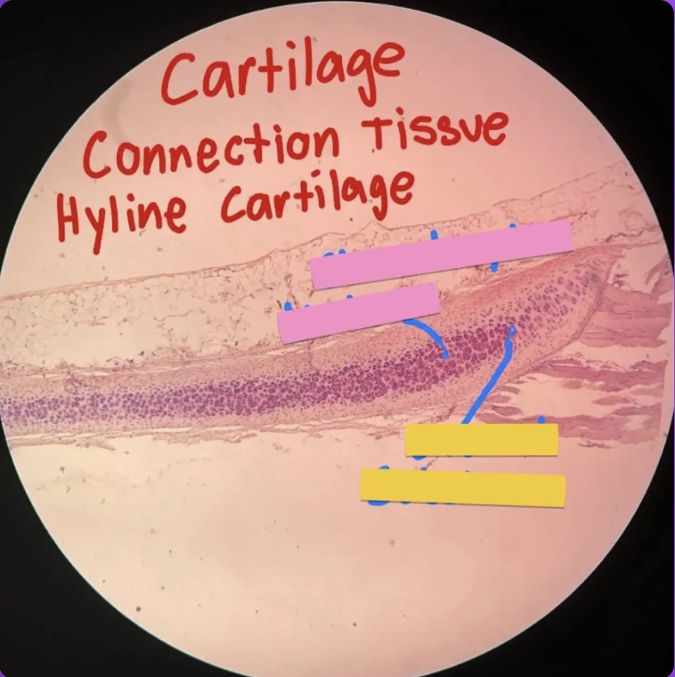<p>What does the yellow box represent?</p>