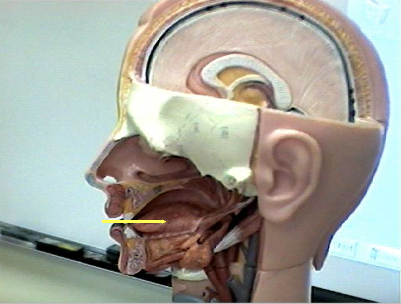 <p>Identify the organs of the digestive tract.</p>