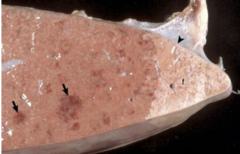 <p>What is being shown on this gross image?</p>