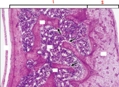 <p>What bone type is labeled 1?</p>