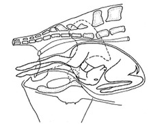 <p>Describe this camelid dystocia</p>