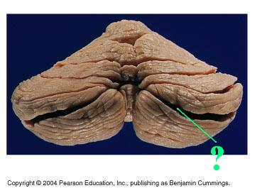 <p>Identify the indicated groove of the cerebellum</p>