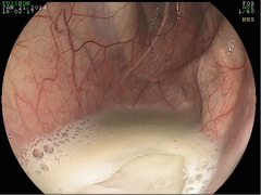 <p>Guttural pouch empyema is a common complication of what disease?</p>