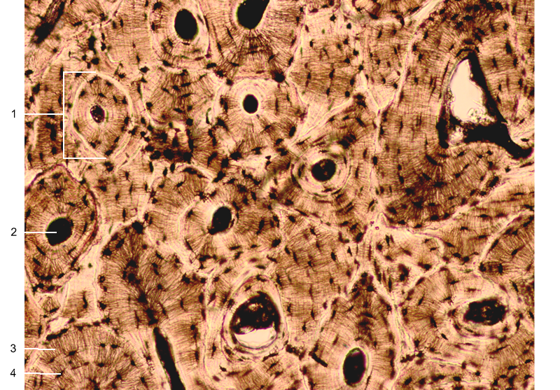 <p>D: Hard, calcified matrix containing many collagen fibers; osteocytes lie inlacunae. Very well vascularized.</p><p>F: Supports and protects </p><p>L: bones</p>