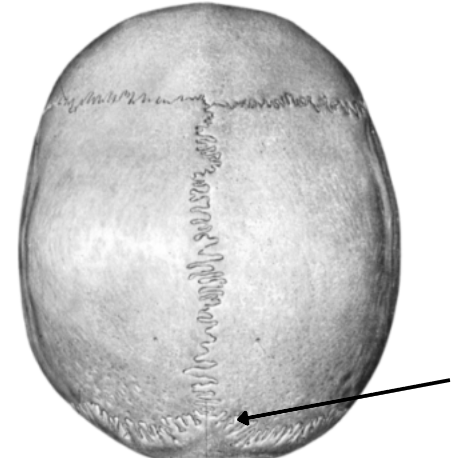 <p>Lambdoid(al) suture connects?</p>