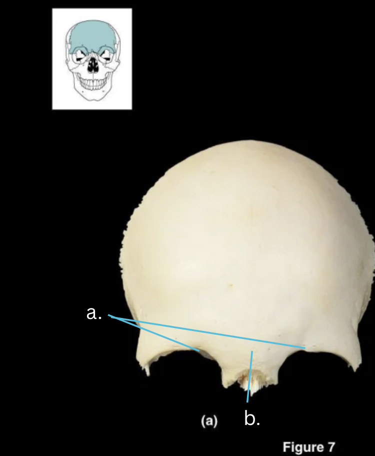 <p>Name bone and structures</p>