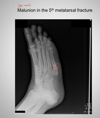 <p>Non-union</p>