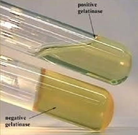 <p>Nutrient Gelatin substrate</p>