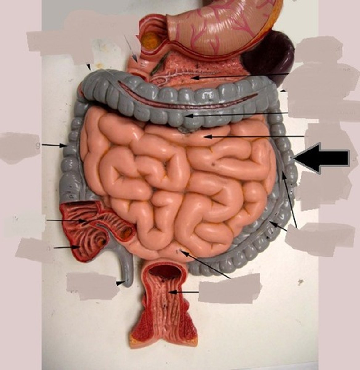 <p>colon/o</p>