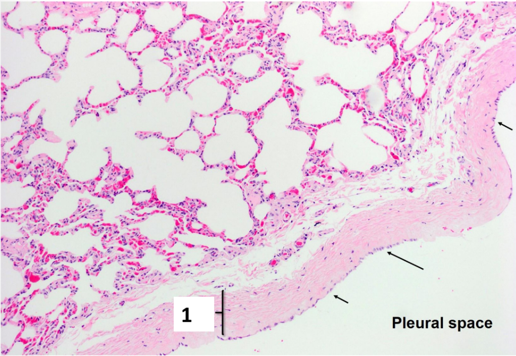 <p>Name the structure indicated by the black arrow.</p>