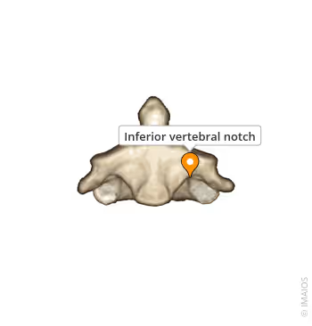 <p>What General Structure of Vertebrae? </p>