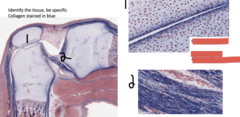 <p>Identify the two tissues. Collagen is stained in blue</p>