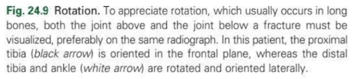 <p>rotation</p>