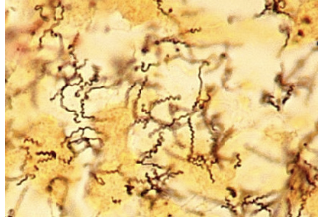 <p>what bacterial shape is this?</p>