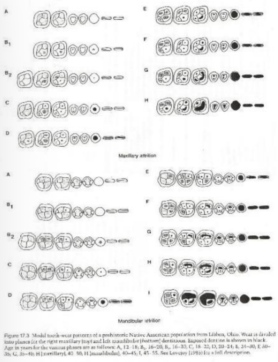 <ul><li><p>Exposure of dentine</p></li><li><p>Most useful for prehistoric or paleo contexts</p></li><li><p>Not very accurate in modern context (~60-75% for adults ± 10yrs, but 90% for ± 50yrs)</p></li></ul><p></p>