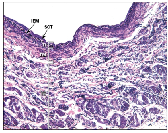 <ul><li><p>Large veins</p><ul><li><p>Thicker tunica interna</p><ul><li><p>More connective tissue</p></li></ul></li><li><p>Tunica media</p><ul><li><p>thin</p></li></ul></li><li><p>Tunica externa thickest layer</p><ul><li><p>Composed of elastic/collagen fibers; vasa vasorum</p></li></ul></li></ul></li></ul><p></p>
