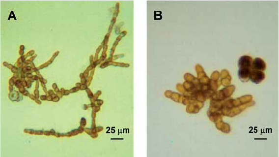<p>Identify the male and female gametophyte of Laminaria brown algae (phylum Phaeophyta).</p>