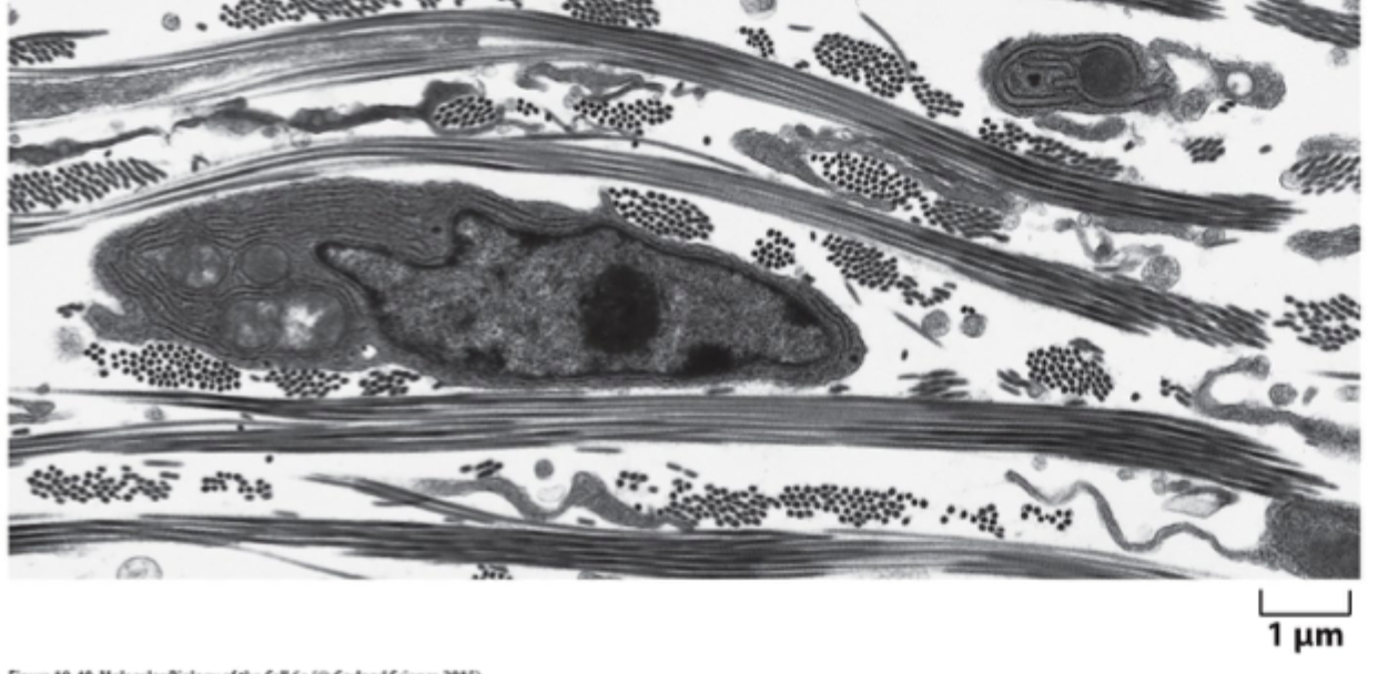 <p>Hvilke tre hovedklasser af makromolekyler består ECM af?</p>