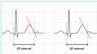 <ul><li><p>intersection of T wave maximum slope with the isoelectric line </p></li></ul><p></p><p></p>