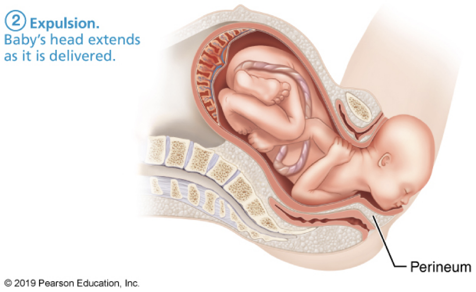 <p><strong>labor: expulsion stage</strong></p><ul><li><p>cervix fully ____</p></li><li><p>typically <strong>1-2 hrs at 1st birth</strong>, shorter for subsequent births</p></li><li><p>strong contractions every <strong>2-3 min</strong>, last ~1 min</p></li><li><p>crowning: ___</p></li></ul><p></p>