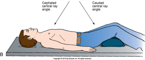 <p>CR is angled towards feet and away from head</p>