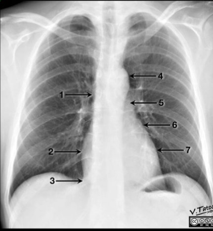 <p>number 6 on the image is referring to what structure?</p>