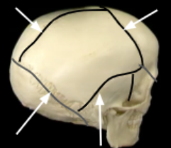 <p>what are these suture lines</p>