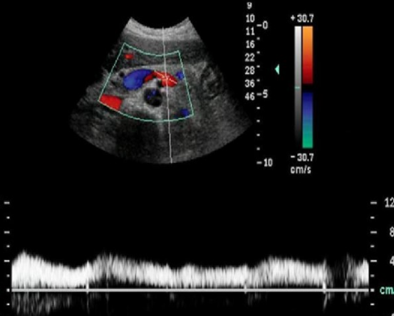 <p>Identify this image. </p>