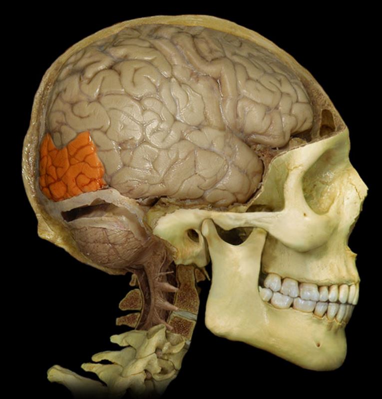 term image